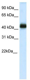 WB Suggested Anti-NKX2-4 Antibody Titration: 0.2-1 ug/ml; ELISA Titer: 1:312500; Positive Control: Human Testis