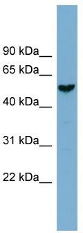 WB Suggested Anti-FAM83E Antibody Titration: 0.2-1 ug/ml; Positive Control: NCI-H226 cell lysateFAM83E is supported by BioGPS gene expression data to be expressed in NCIH226