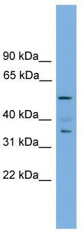 WB Suggested Anti-Nobox Antibody Titration: 0.2-1 ug/ml; ELISA Titer: 1:312500; Positive Control: Mouse Muscle