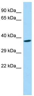 Host: Rabbit; Target Name: FAM108A1; Sample Tissue: Fetal Brain lysates; Antibody Dilution: 1.0ug/ml