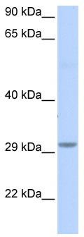 WB Suggested Anti-FAM108B1 Antibody Titration: 0.2-1 ug/ml; ELISA Titer: 1:312500; Positive Control: Human brain