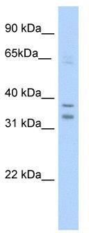 WB Suggested Anti-NR1I3 Antibody Titration: 5.0 ug/ml; Positive Control: SP2/0 cell lysate
