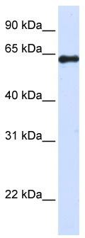 WB Suggested Anti-DENND6A Antibody Titration: 0.2-1 ug/ml; ELISA Titer: 1: 1562500; Positive Control: 293T cell lysate