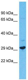Host: Rabbit; Target Name: FAM124A; Sample Tissue: Jurkat Whole cell lysates; Antibody Dilution: 1.0ug/ml