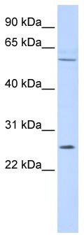 WB Suggested Anti-FAM124A Antibody Titration: 0.2-1 ug/ml; ELISA Titer: 1: 312500; Positive Control: 293T cell lysate