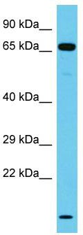 Host: Rabbit; Target Name: NT5DC3; Sample Tissue: Jurkat Whole Cell lysates; Antibody Dilution: 1.0ug/ml