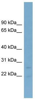 WB Suggested Anti-NT5M Antibody Titration: 0.2-1 ug/ml; Positive Control: Human Liver