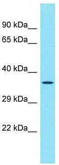 Host: Rabbit; Target Name: MVB12B; Sample Tissue: MDA-MB-435S Whole Cell lysates; Antibody Dilution: 1.0 ug/ml. There is BioGPS gene expression data showing that MVB12B is expressed in MDA-MB435
