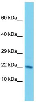 Host: Rabbit; Target Name: NUDT3; Sample Tissue: Hela Whole Cell lysates; Antibody Dilution: 1.0ug/ml. NUDT3 is supported by BioGPS gene expression data to be expressed in HeLa