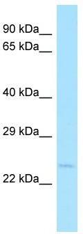 Host: Rabbit; Target Name: NUDT14; Sample Tissue: Fetal Heart lysates; Antibody Dilution: 1.0ug/ml
