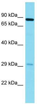 Host: Rabbit; Target Name: NYAP2; Sample Tissue: Fetal Lung lysates; Antibody Dilution: 1.0 ug/ml