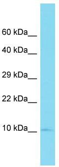 Host: Rabbit; Target Name: FAM153C; Sample Tissue: Placenta lysates; Antibody Dilution: 1.0 ug/ml