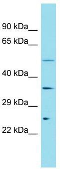 Host: Rabbit; Target Name: FAM166A; Sample Tissue: 293T Whole Cell lysates; Antibody Dilution: 1.0 ug/ml