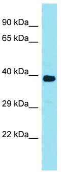 Host: Rabbit; Target Name: FAM166A; Sample Tissue: Jurkat Whole Cell lysates; Antibody Dilution: 1.0 ug/ml