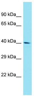 Host: Rabbit; Target Name: FAM170A; Sample Tissue: RPMI-8226 Whole Cell lysates; Antibody Dilution: 1.0 ug/ml