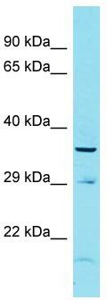 Host: Rabbit; Target Name: FAM170B; Sample Tissue: Hela Whole cell lysates; Antibody Dilution: 1.0 ug/ml