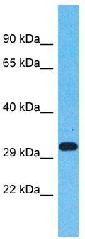 Host: Rabbit; Target Name: OR5AN1; Sample Tissue: Fetal Lung lysates; Antibody Dilution: 1.0 ug/ml