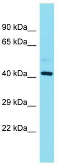 Host: Rabbit; Target Name: FAM181B; Sample Tissue: Placenta lysates; Antibody Dilution: 1.0 ug/ml