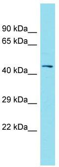 Host: Rabbit; Target Name: FAM181B; Sample Tissue: Placenta lysates; Antibody Dilution: 1.0 ug/ml