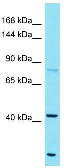 Host: Rabbit; Target Name: FAM184A; Sample Tissue: ACHN Whole Cell lysates; Antibody Dilution: 1.0 ug/ml