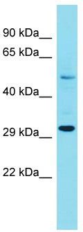 Host: Rabbit; Target Name: FAM185A; Sample Tissue: 293T Whole Cell lysates; Antibody Dilution: 1.0 ug/ml