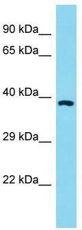 Host: Rabbit; Target Name: OR11A1; Sample Tissue: HT1080 Whole Cell Lysate lysates; Antibody Dilution: 1.0ug/ml