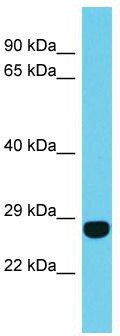 Host: Rabbit; Target Name: FAM204A; Sample Tissue: Jurkat Whole Cell lysates; Antibody Dilution: 1.0ug/ml