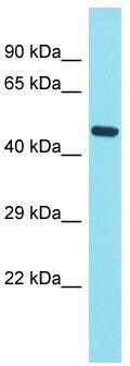 Host: Rabbit; Target Name: FAM221B; Sample Tissue: Hela Whole cell lysates; Antibody Dilution: 1.0 ug/ml