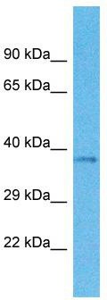Host: Rabbit; Target Name: OR4M1; Sample Tissue: 721_B Whole Cell lysates; Antibody Dilution: 1.0 ug/ml