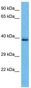 Host: Rabbit; Target Name: OR5H2; Sample Tissue: Jurkat Whole Cell lysates; Antibody Dilution: 1.0 ug/ml