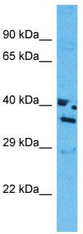 Host: Rabbit; Target Name: OR13J1; Sample Tissue: MCF7 Whole cell lysates; Antibody Dilution: 1.0ug/ml