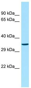 Host: Rabbit; Target Name: OR51V1; Sample Tissue: Fetal Heart lysates; Antibody Dilution: 1.0ug/ml
