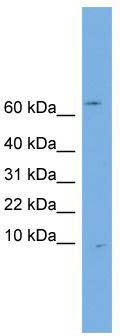 WB Suggested Anti-OTOS Antibody Titration: 0.2-1 ug/ml; Positive Control: Jurkat cell lysate