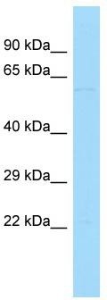 Host: Rabbit; Target Name: PATL2; Sample Tissue: Hela Whole Cell lysates; Antibody Dilution: 1.0 ug/ml