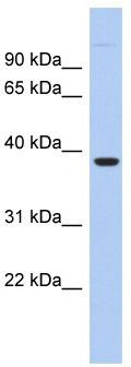 LOC161247 Antibody (against the N terminal of LOC161247) (50ug) validated by WB using Fetal liver cell lysate at 0.2-1 ug/ml.