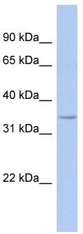 WB Suggested Anti-FITM1 Antibody Titration: 0.2-1 ug/ml; ELISA Titer: 1: 62500; Positive Control: 721_B cell lysate