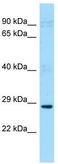 WB Suggested Anti-Pdcl2 Antibody; Titration: 1.0 ug/ml; Positive Control: Mouse Testis