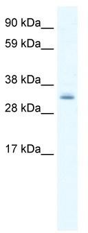 WB Suggested Anti-PDLIM1 Antibody Titration: 0.625 ug/ml; ELISA Titer: 1:1562500; Positive Control: NIH/3T3 cell lysate