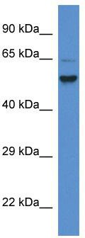 WB Suggested Anti-Pigs Antibody; Titration: 1.0 ug/ml; Positive Control: Mouse Small Intestine