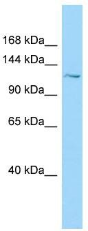 WB Suggested Anti-PKD1L1 Antibody; Titration: 1.0 ug/ml; Positive Control: NCI-H226 Whole Cell