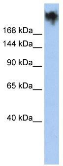 WB Suggested Anti-PKDREJ Antibody Titration: 0.2-1 ug/ml; ELISA Titer: 1:12500; Positive Control: HepG2 cell lysate