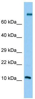 Host: Rabbit; Target Name: PLA2G2C; Sample Tissue: Jurkat Whole Cell lysates; Antibody Dilution: 1.0 ug/ml
