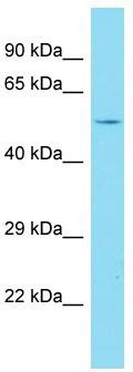 Host: Rabbit; Target Name: FBXO47; Sample Tissue: Jurkat Whole Cell lysates; Antibody Dilution: 1.0ug/ml
