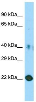 Host: Rabbit; Target Name: C11orf34; Sample Tissue: HT1080 Whole Cell lysates; Antibody Dilution: 1.0ug/ml