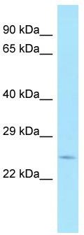 WB Suggested Anti-PLSCR2 Antibody; Titration: 1.0 ug/ml; Positive Control: Fetal Heart