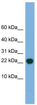 WB Suggested Anti-POP5 Antibody Titration: 0.2-1 ug/ml; Positive Control: Human Lung