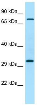 WB Suggested Anti-PPFIA4 Antibody; Titration: 1.0 ug/ml; Positive Control: RPMI-8226 Whole Cell