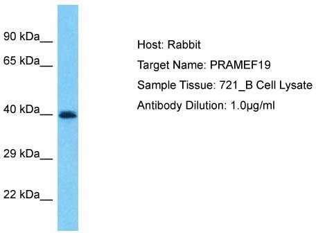 Host: Rabbit; Target Name: PRAMEF19; Sample Tissue: 721_B Whole Cell lysates; Antibody Dilution: 1.0ug/ml