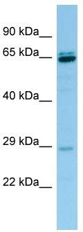 WB Suggested Anti-PRB3 Antibody; Titration: 1.0 ug/ml; Positive Control: Hela Whole Cell