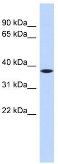 WB Suggested Anti-C22orf30 Antibody Titration: 0.2-1 ug/ml; ELISA Titer: 1:1562500; Positive Control: Hela cell lysate